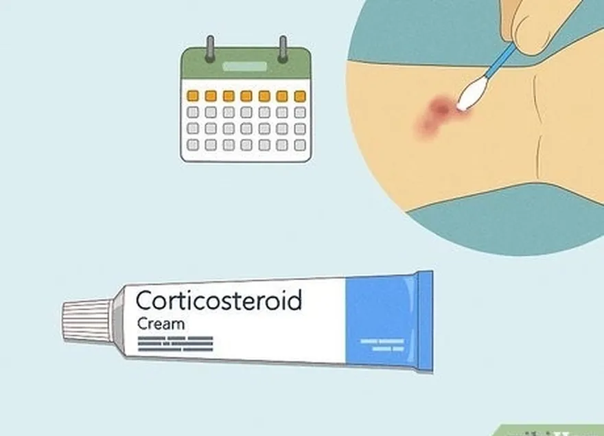 adım 1 bir haftaya kadar reçetesiz satılan bir kortikosteroid krem kullanın.