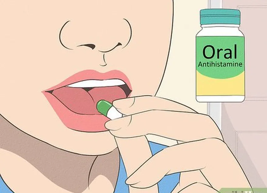 adım 4 oral antihistaminikler ile ağrınızı azaltın.